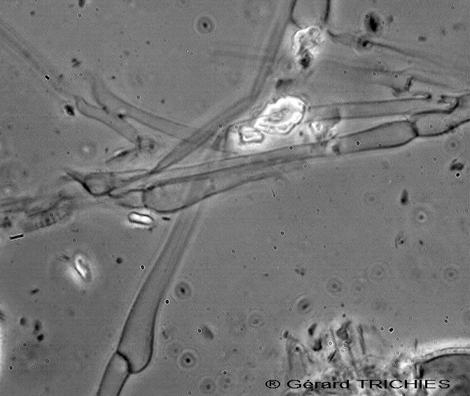 Labile crosticina bianca - foto 3259 (Trechispora farinacea)